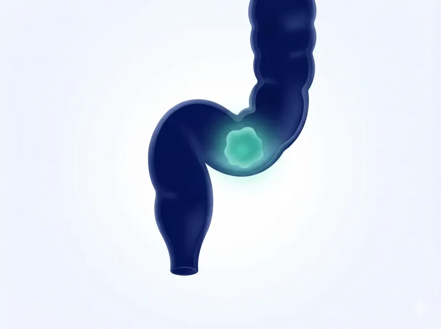Colon & Rectum Cancer