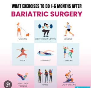 Exercise after Bariatric Surgery 