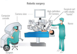 Robotic Surgery in Ahmedabad 