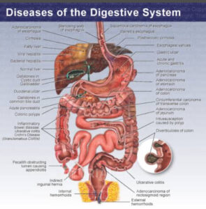 Diseases of Digestive Organs