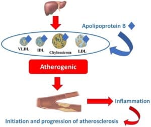 Why ApoB and Non-HDL Cholesterol Are Better Predictors of Cardiovascular Risk Than LDL Cholesterol.
